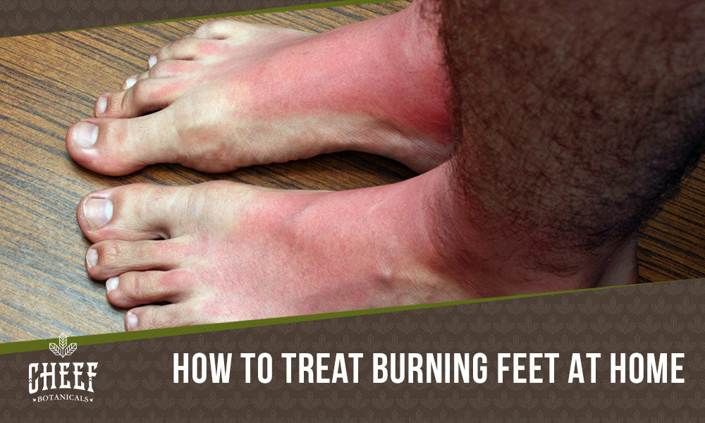 home remedies for burning feet