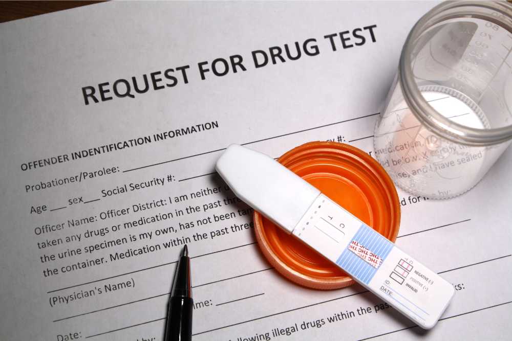 Will Delta 9 Show Up On A Drug Test?